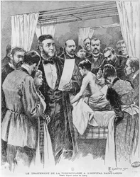 Die Behandlung der Tuberkulose im St. Louis Krankenhaus, Paris, 1890